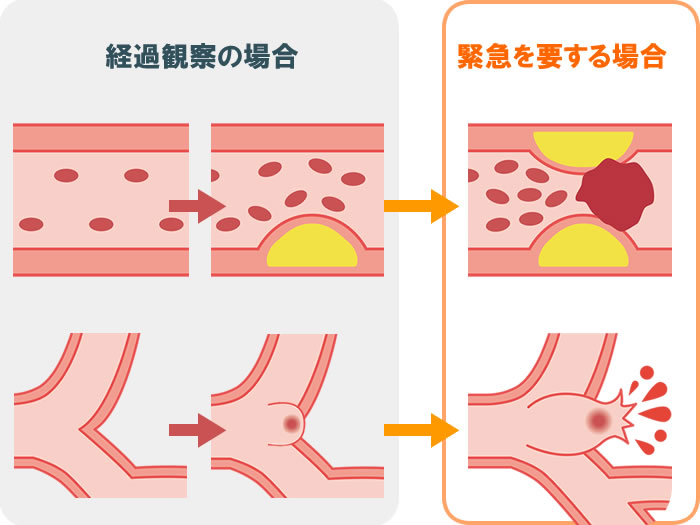 緊急を要する場合と経過観察の場合の図解