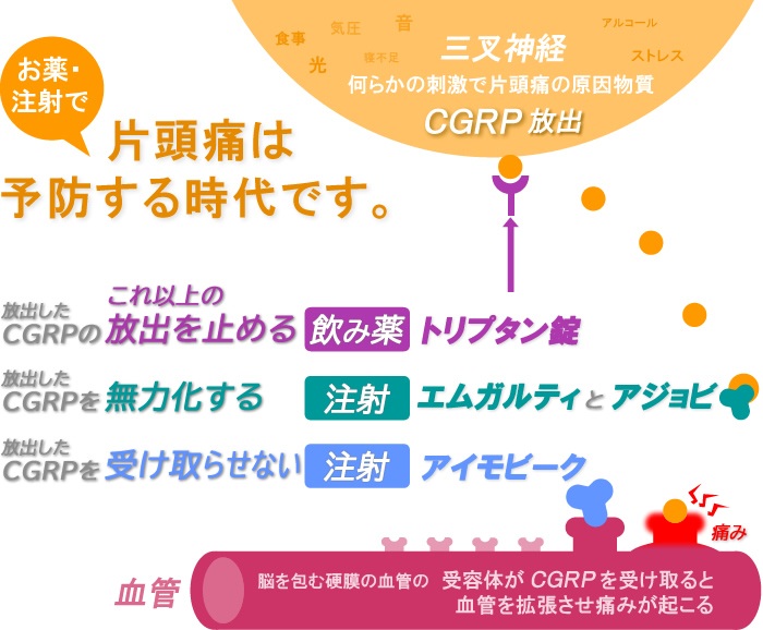 片頭痛の発症メカニズムのイラスト