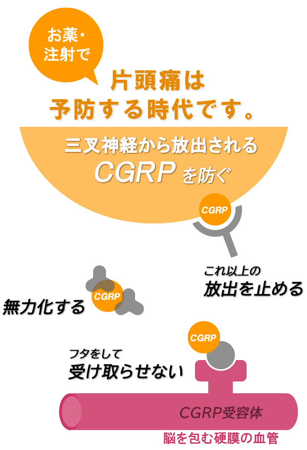 片頭痛の発症メカニズムのイラスト