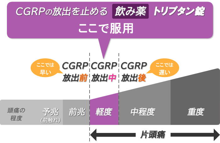 片頭痛の特効薬であるトリプタン錠が効くタイミング
