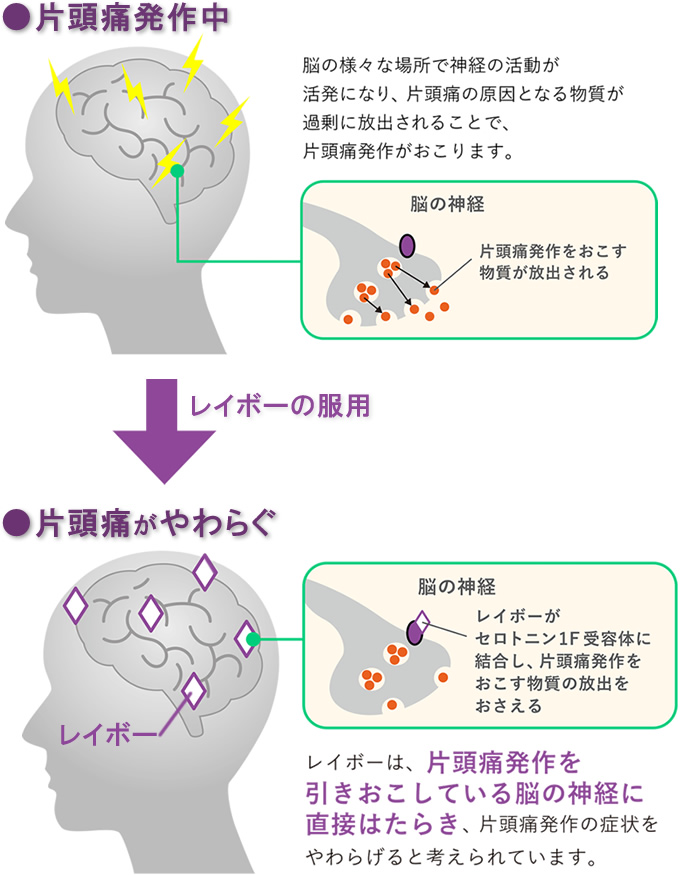 片頭痛だけに効く痛み止めレイボーのしくみの図解